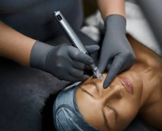 PRO Pen Dermalogica : soin de nanoneedling du visage au Centre Mes à Moi, Pézenas